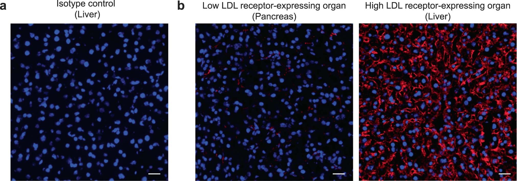 Extended Data Fig. 10: Immunohistochemistry images of LDL receptor staining controls.