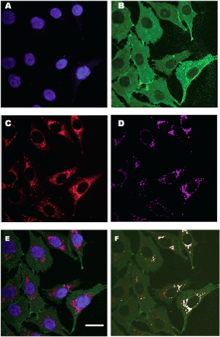 Fig. 7: Cellular colocalization of mitochpondrial lactate (VCTs) and pyruvate transprters (mPCs).