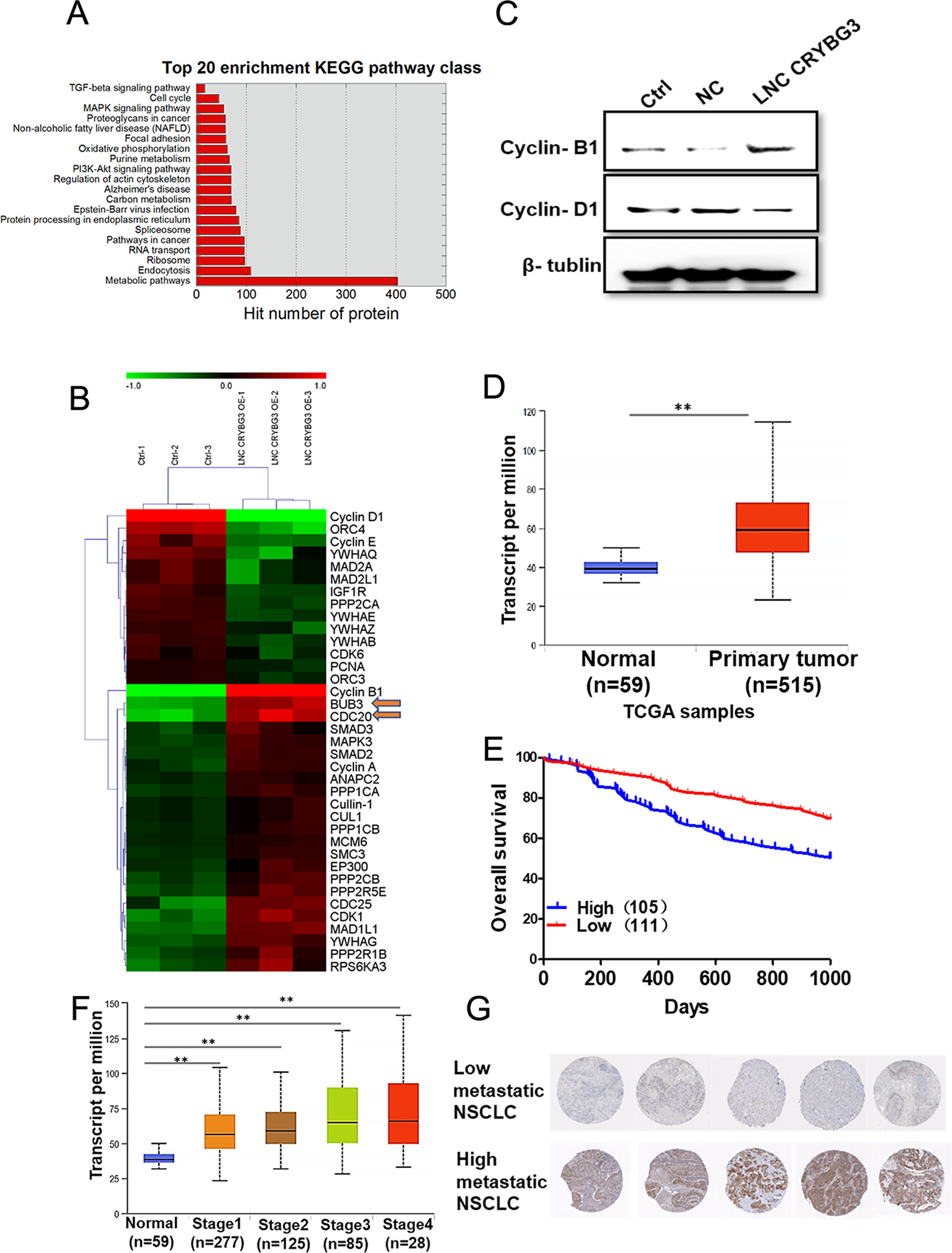 Fig. 3: Overexpression of LNC CRYBG3 promotes tumorigenesis and metastasis by targeting BUB3.