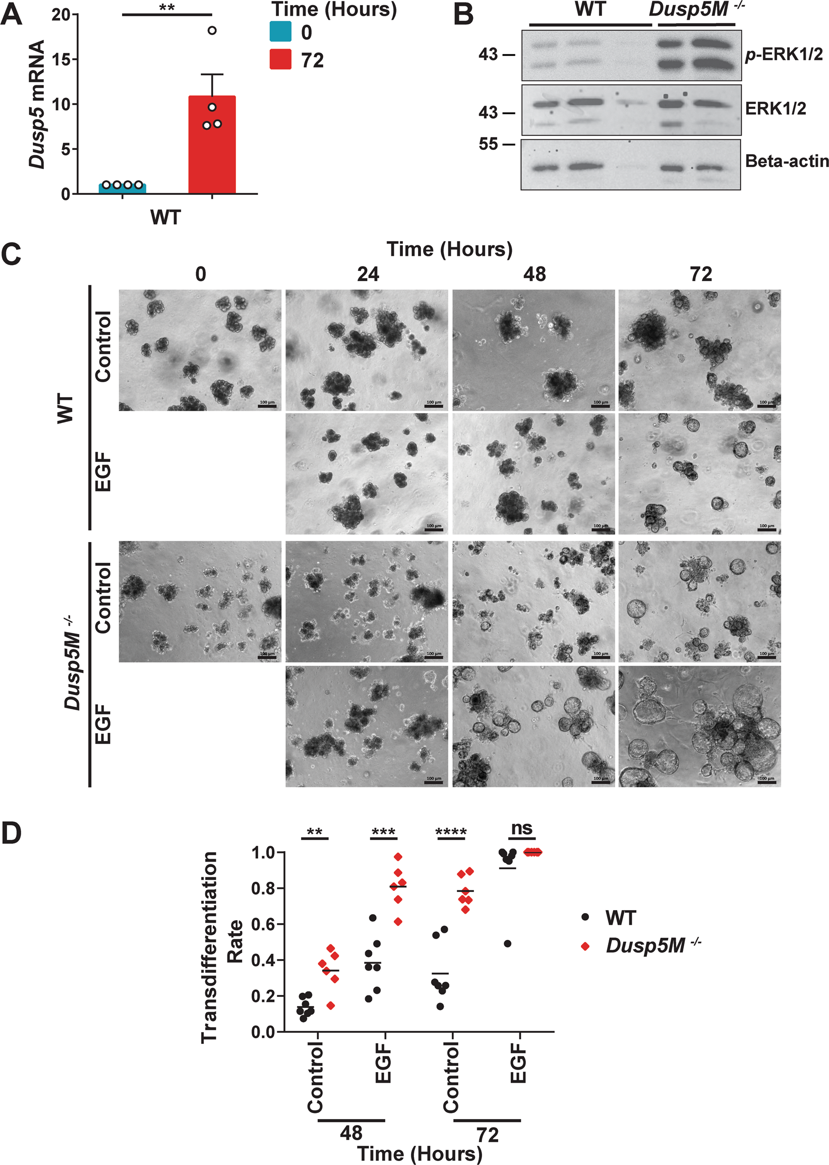 Fig. 3: Loss of DUSP5 results in increased levels of activated ERK1/2 and accelerates the transdifferentiation of pancreatic acinar cells in vitro.