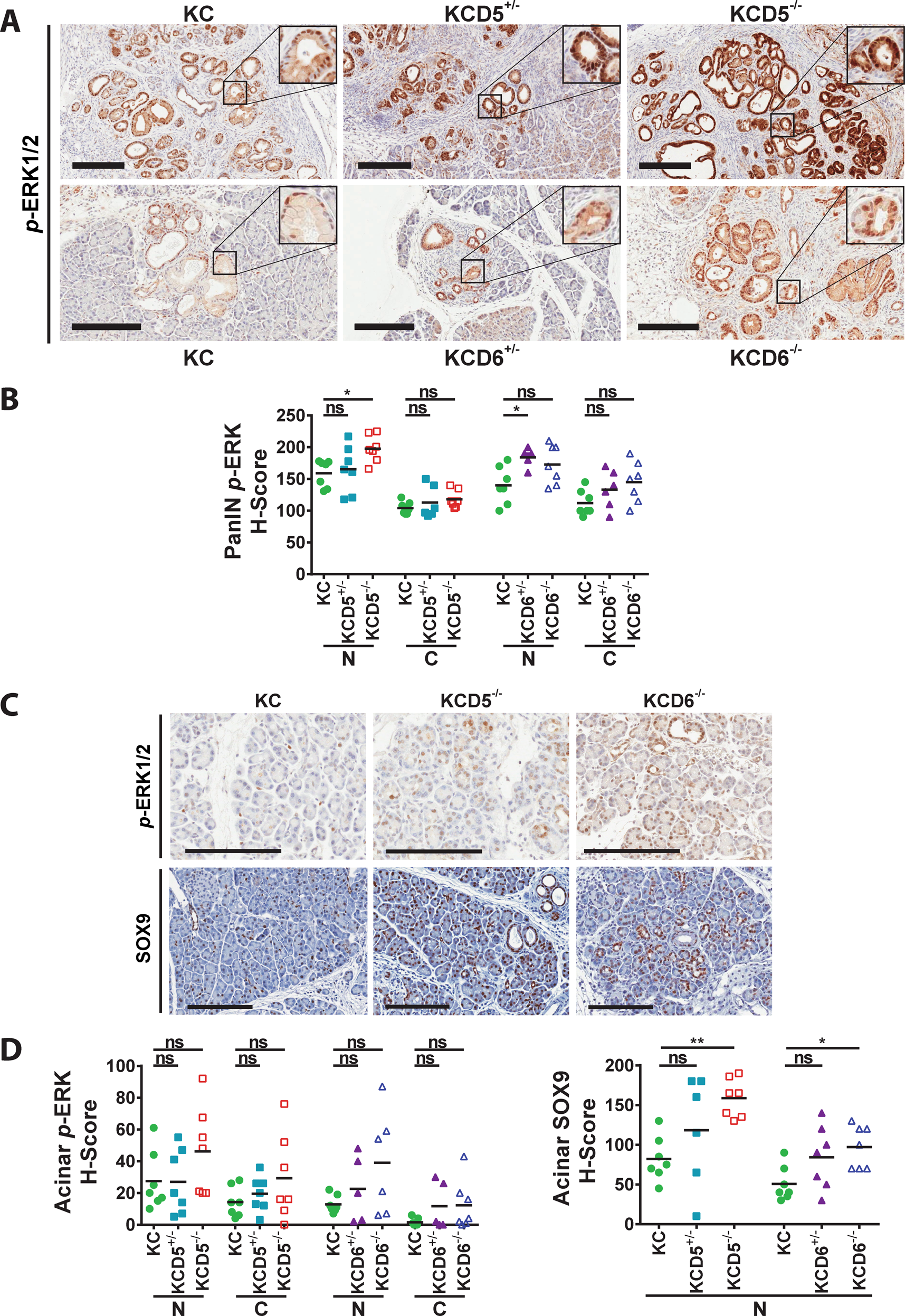 Fig. 4: Loss of either DUSP5 or DUSP6 promotes changes in ERK activation and SOX9 expression during KRASG12D-driven pancreatic carcinogenesis.
