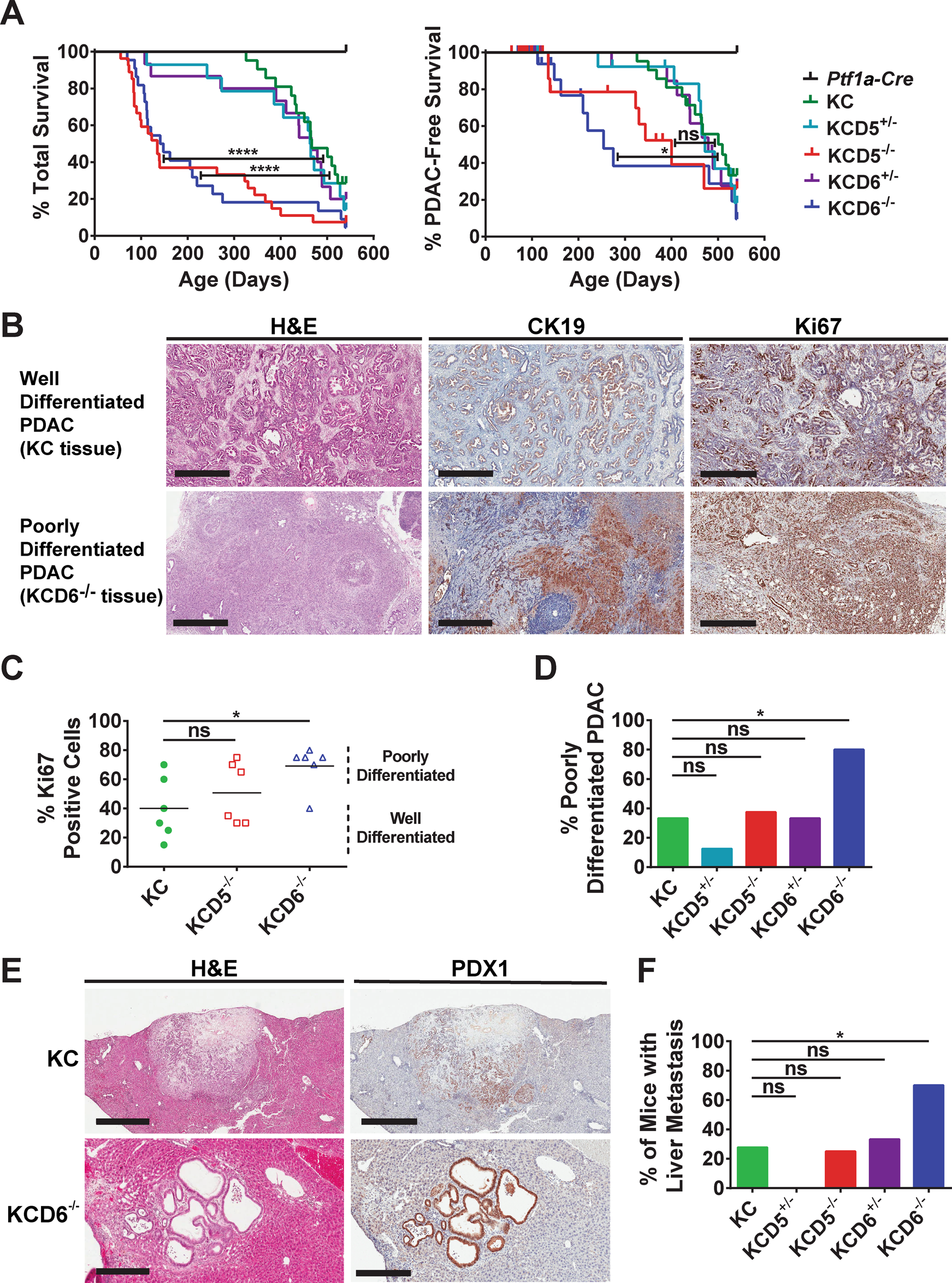 Fig. 5: Loss of DUSP6 drives the accelerated development of highly proliferative, metastatic PDAC.