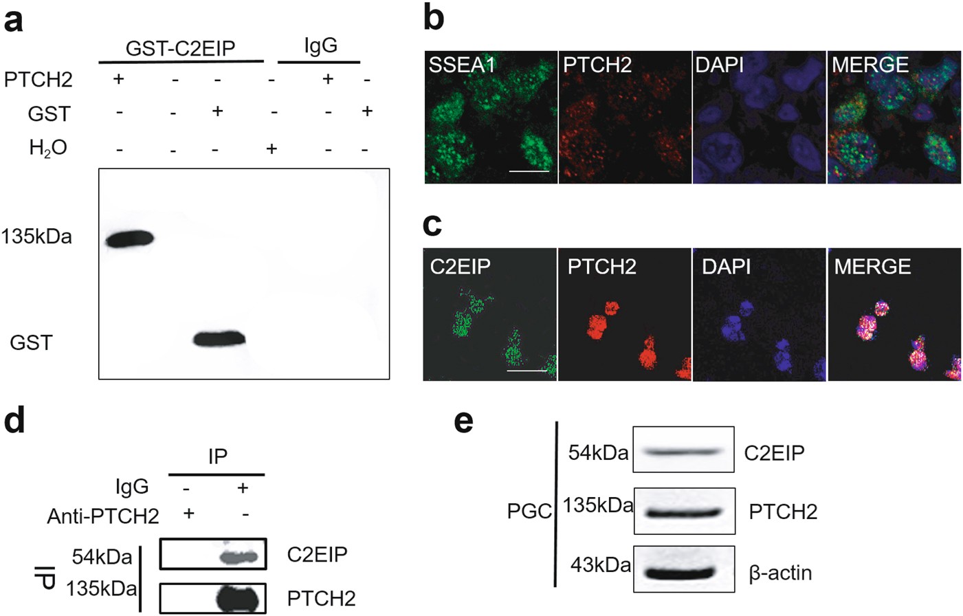 Fig. 6: C2EIP and PTCH2 are co-expressed at the intracellular membrane.