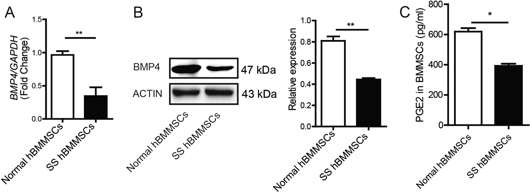 Fig. 6: BMP4 and PGE2 decreased in SS patient’s BMMSCs.