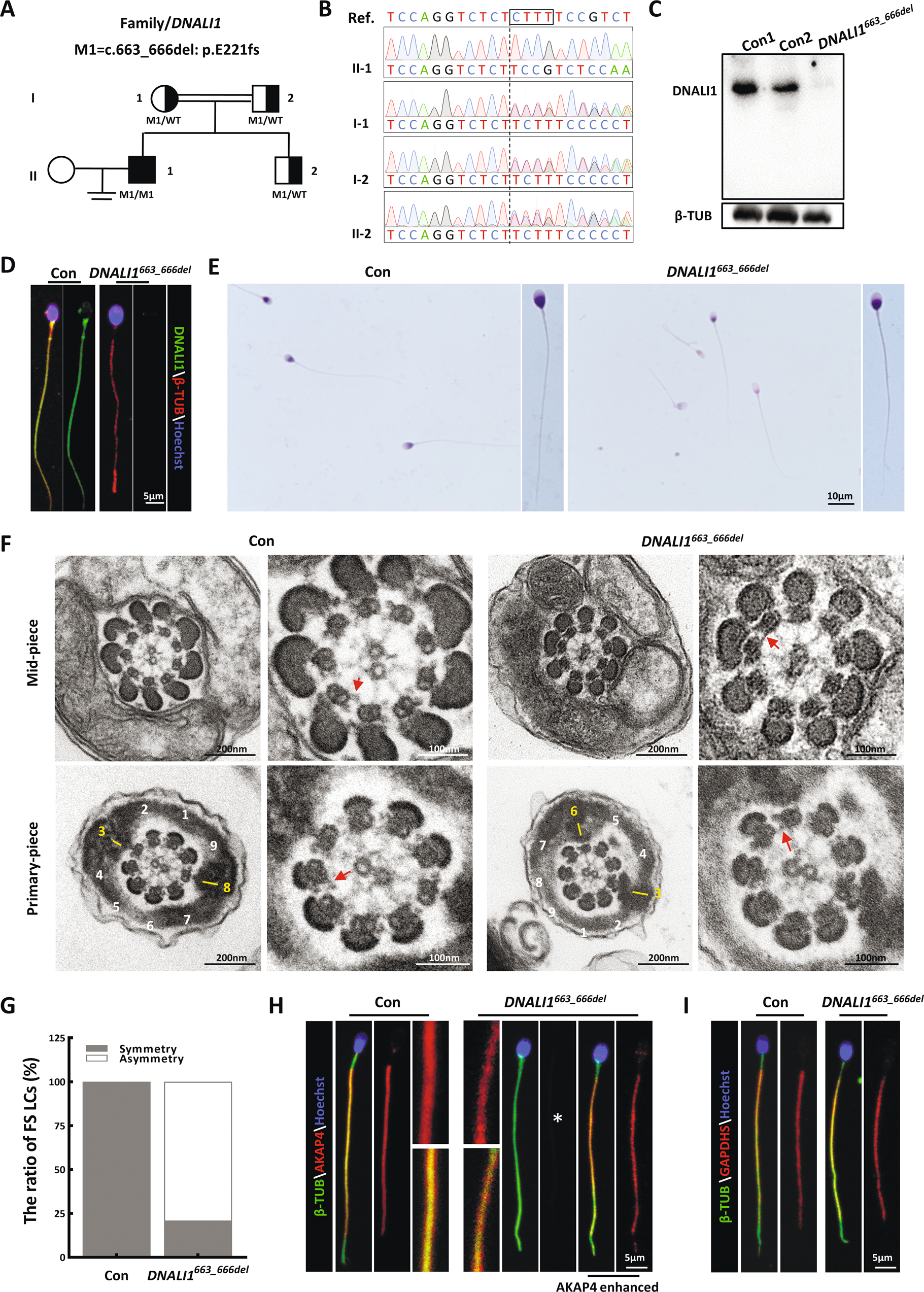 Fig. 1: The DNALI1 loss leads to the asymmetrical development of sperm fibrous sheaths in humans.