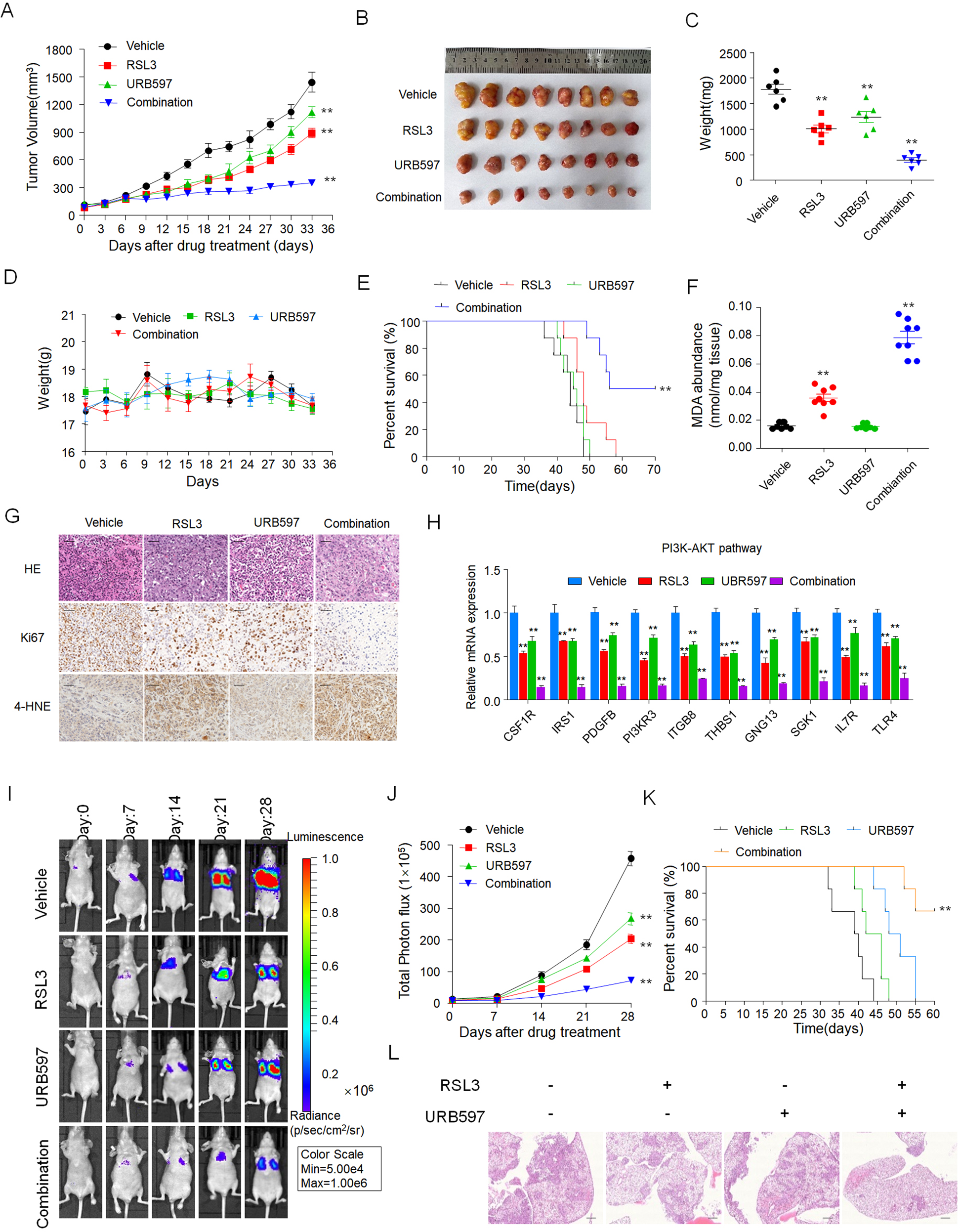Fig. 7: Synergy of URB597 with ferroptosis inducers significantly inhibits RCC tumor growth and metastasis in vivo.