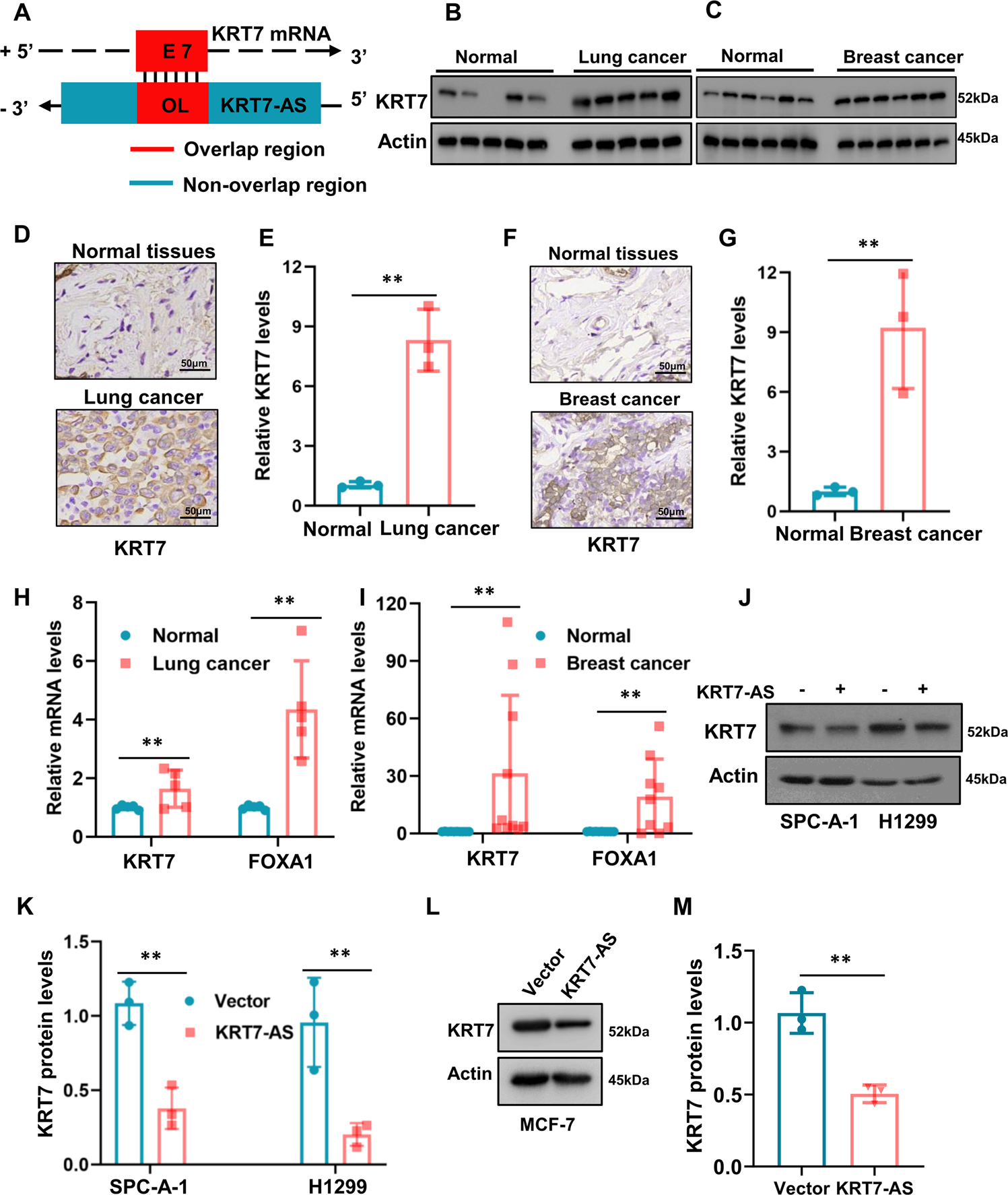 Fig. 6: KRT7-AS increases the levels of oncogenic KRT7 in lung cancer and breast cancer.