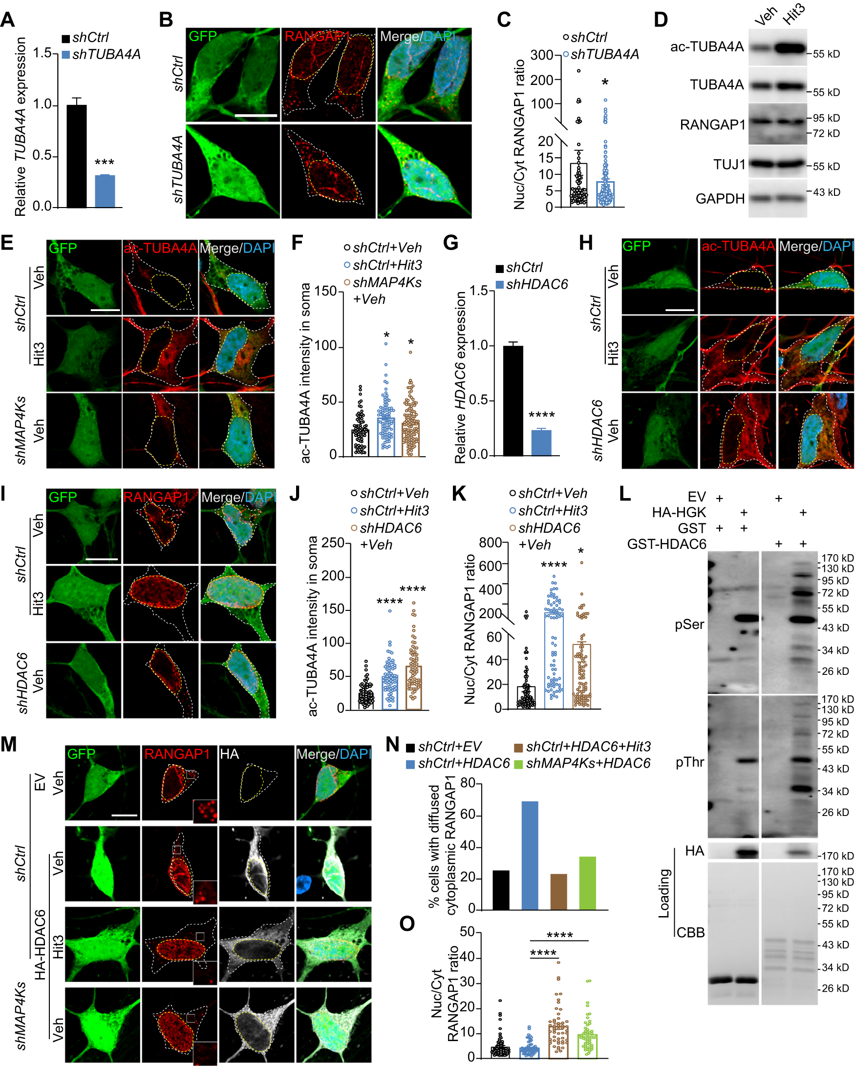 Fig. 6: A role of the MAP4K-HDAC6-TUBA4A axis in subcellular distribution of RANGAP1.