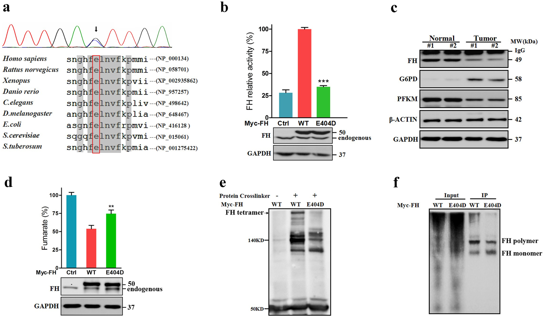 Fig. 3: FH (E404D) was identified in Patient-1 by exome sequencing.