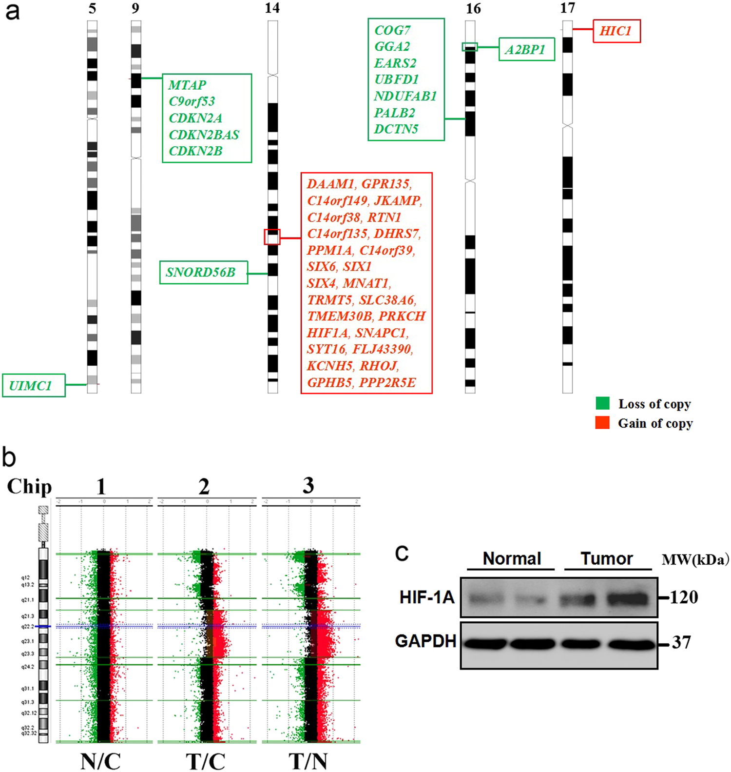 Fig. 4: Somatic HIF1A duplication was identified in cardiac tumors of Patient-1 by aCGH