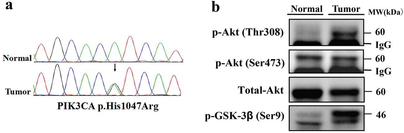Fig. 5: Recurrent hotspot PI3KCA (H1047) was first identified in cardiac tumor tissue.