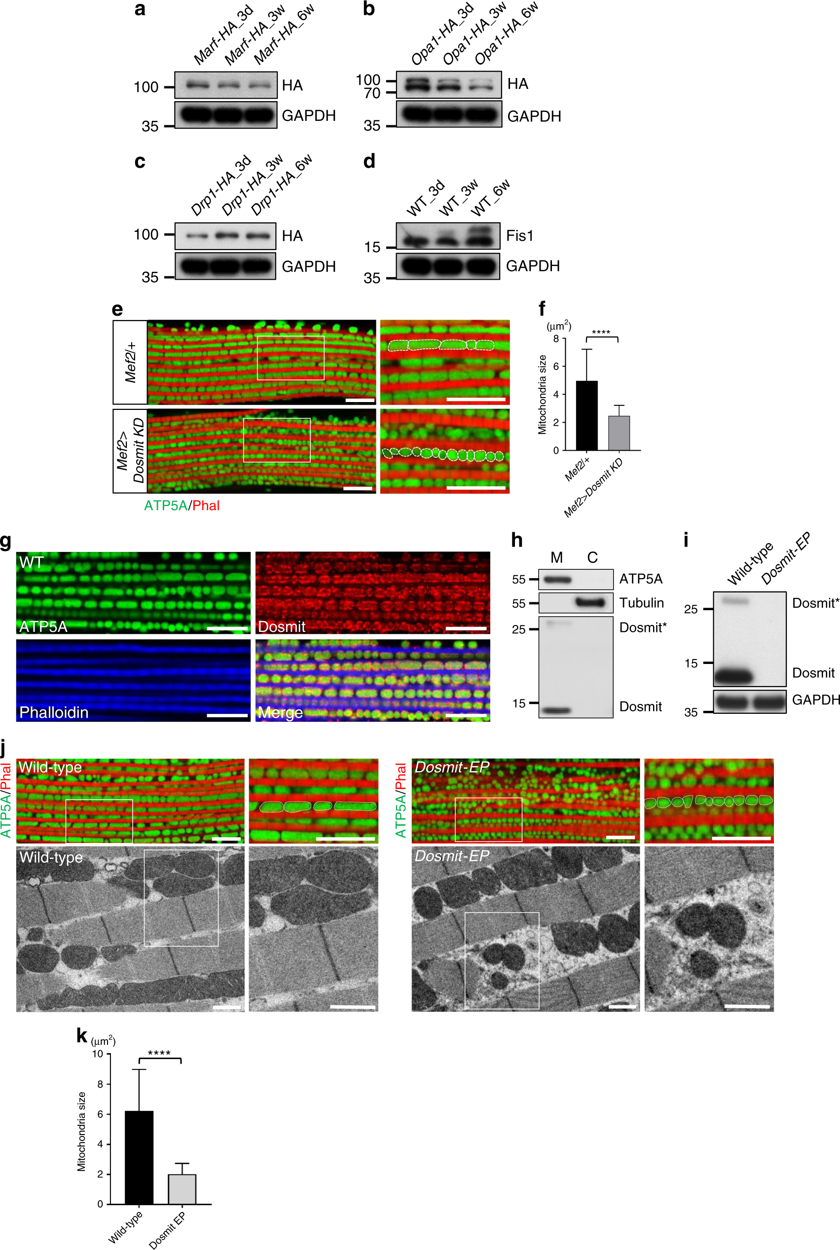 Fig. 2: Knocking down a mitochondria-associated protein, Dosmit, results in significant differences in mitochondrial size and shape.