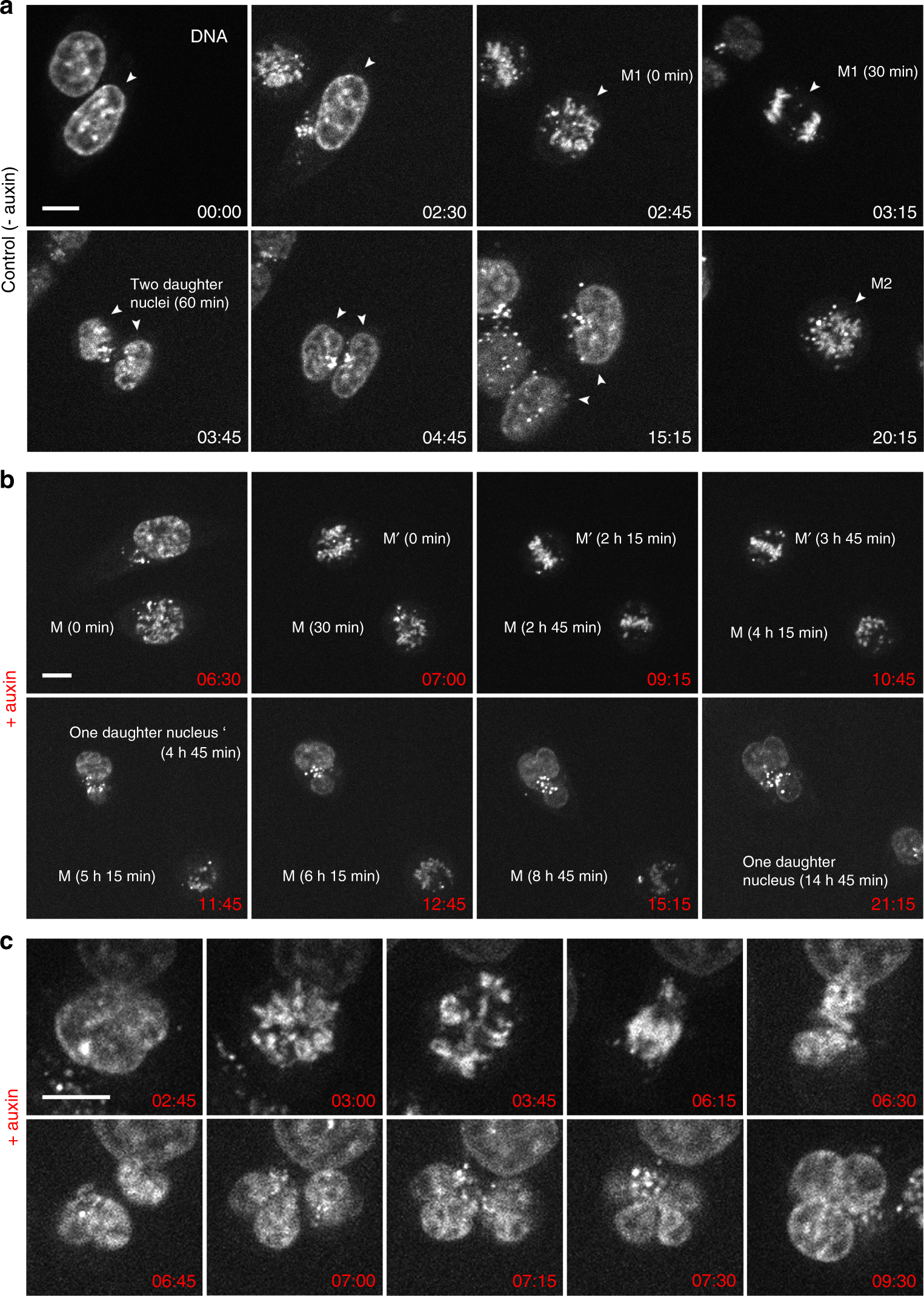 Fig. 1: Live-cell microscopy demonstrating prolonged abnormal mitosis with subsequent formation of one endomitotic multilobulated nucleus (MLN) in cohesin depleted cells.
