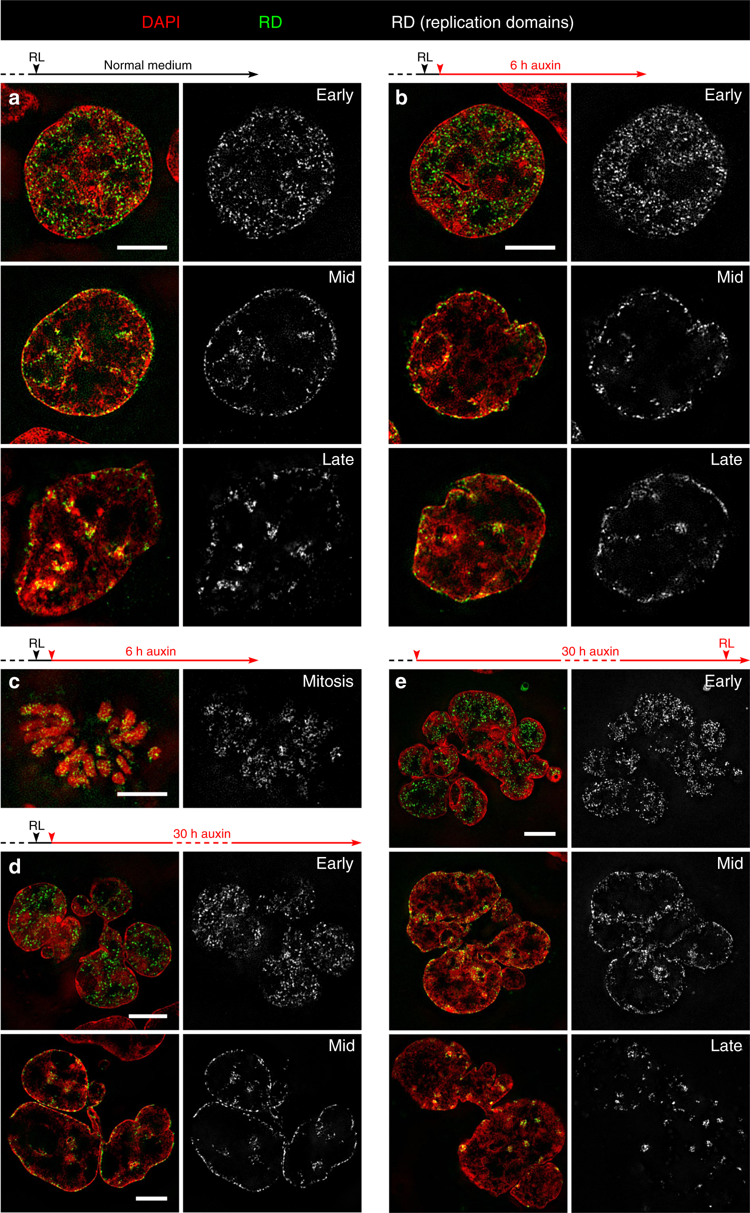 Fig. 6: Maintenance, postmitotic rebuilding and de novo formation of typical replication patterns after cohesin depletion.