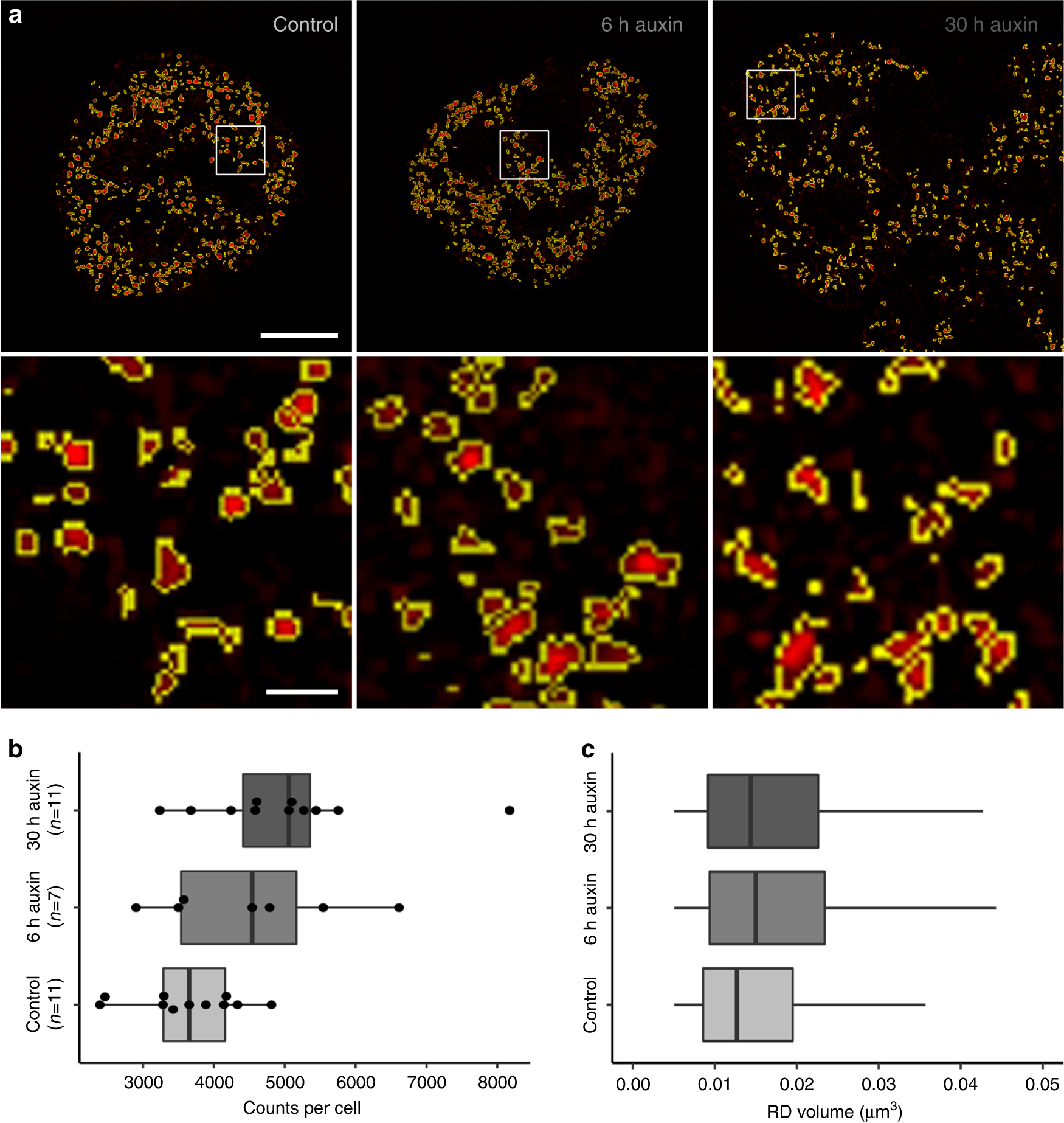 Fig. 8: Segmentation of individual replication domains (RDs), pulse-labeled in early S-phase, indicate structural changes after cohesin depletion.