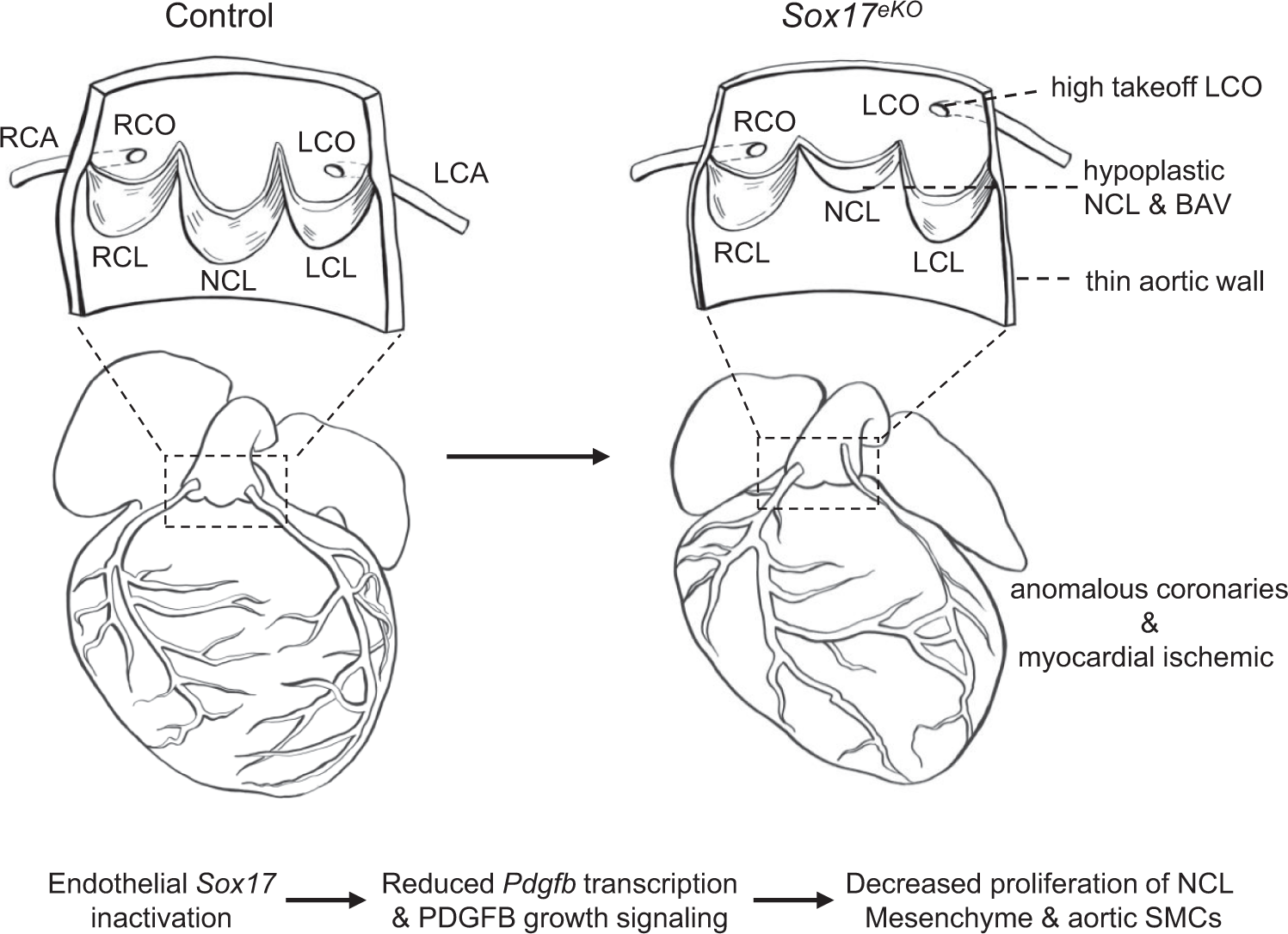 Fig. 10: Summary of molecular, cellular and tissue structural changes in the mouse model of BAV syndrome caused by the Sox17 inactivation in aortic root endothelium.