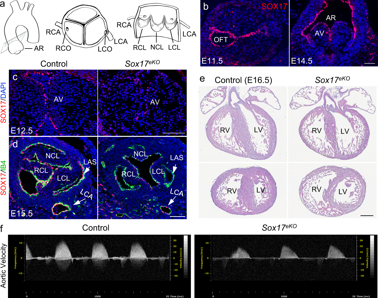 Fig. 1: Sox17 expression in the aortic root endothelium is necessary for heart development and embryonic survival.