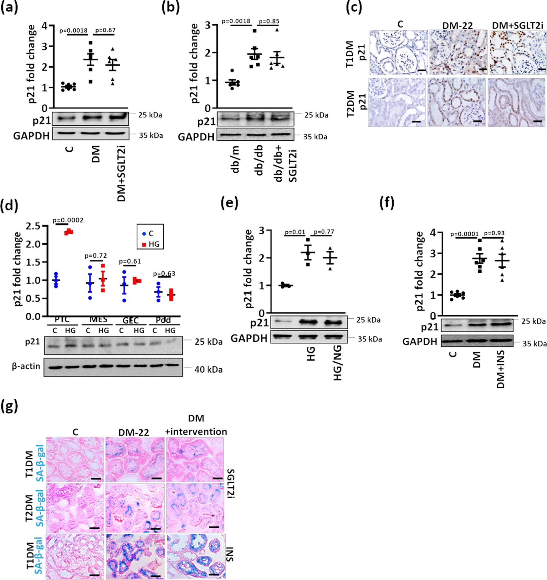 Fig. 2: Sustained p21 expression despite glucose lowering in experimental DKD.