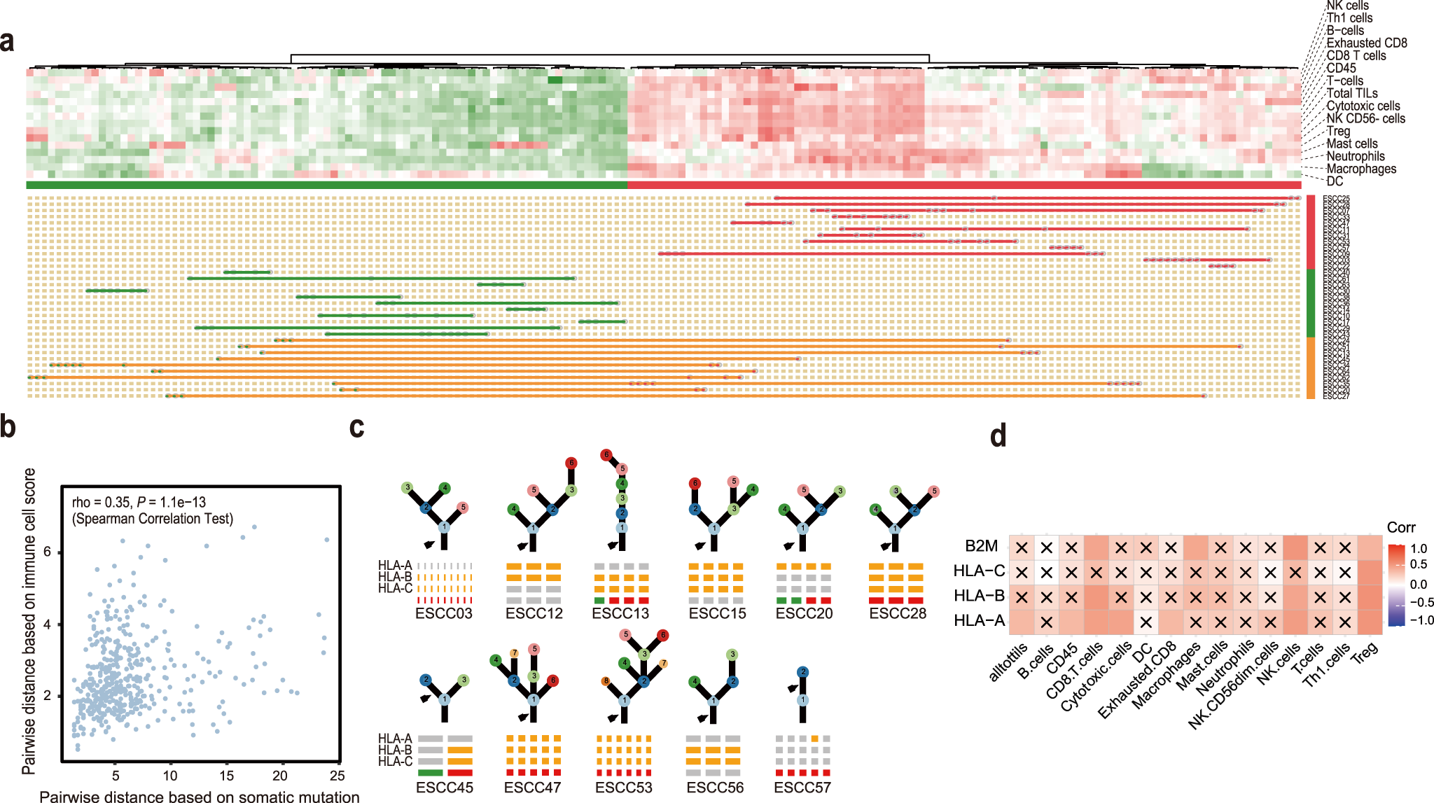Fig. 4: Immune infiltrate heterogeneity in ESCC.