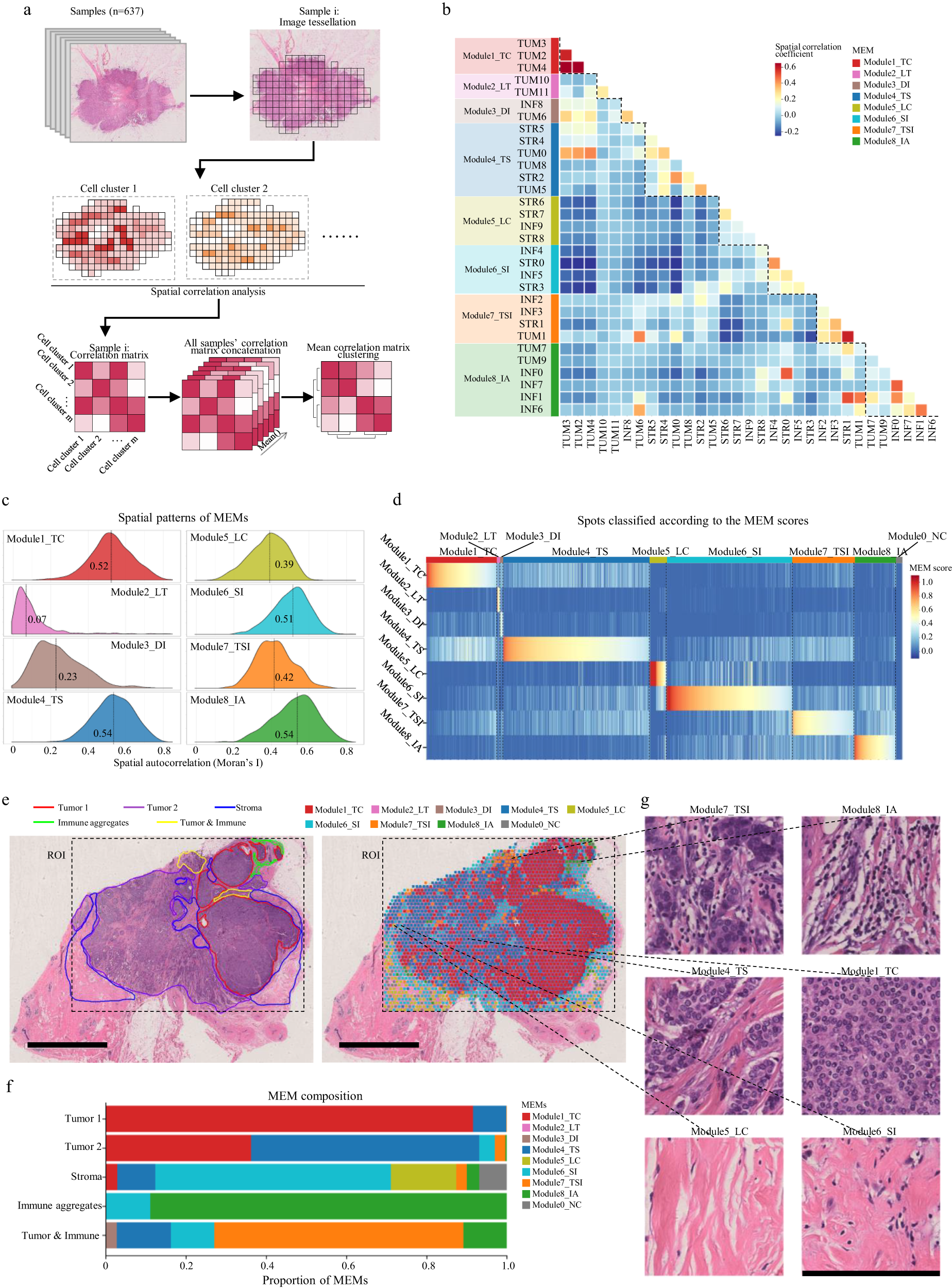 Fig. 6: Recurrent micro-ecological modules characterize the spatial diversity of breast cancer ecosystem.
