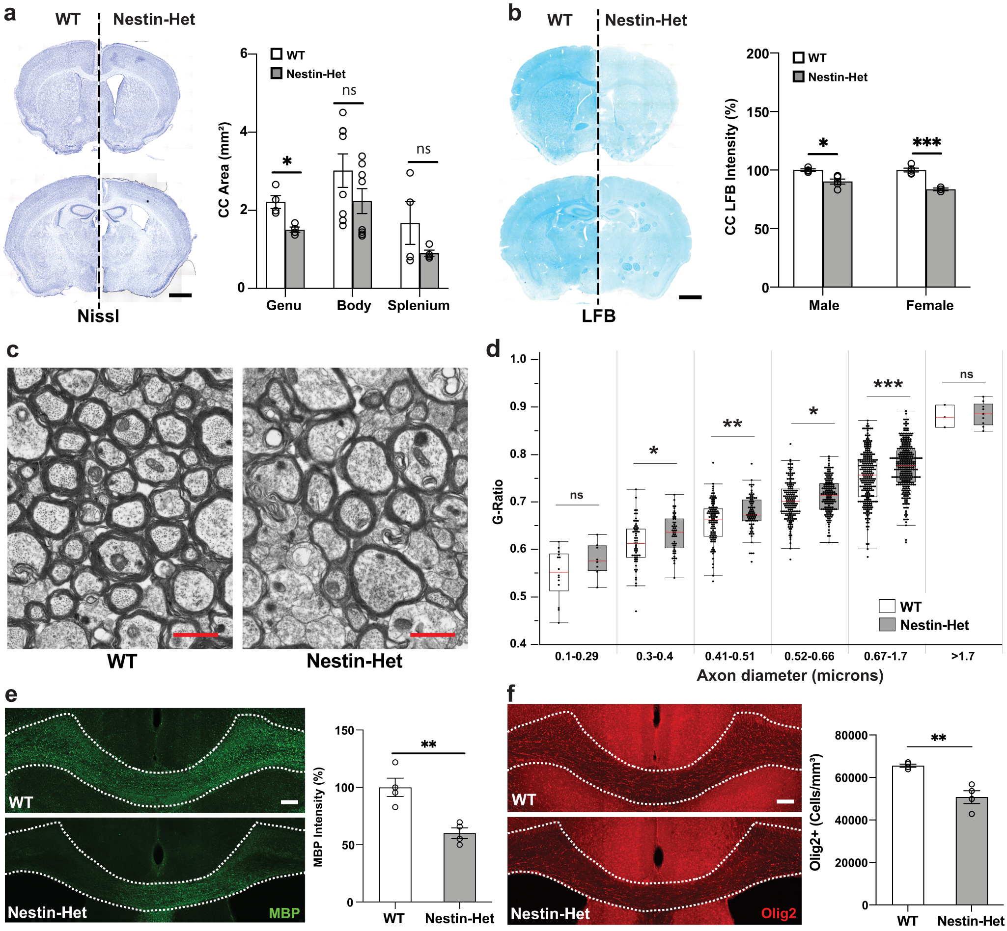 Fig. 2: Abnormal myelin sheath integrity and fewer oligodendrocytes in an Anks1b haploinsufficiency mouse model.