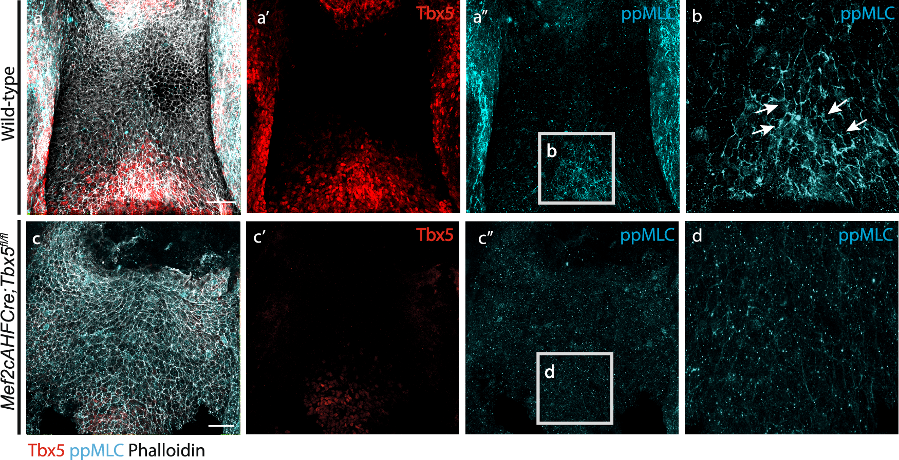 Fig. 7: Deletion of Tbx5 disrupts the cellular localization of diphosphorylated myosin light chain in the dorsal pericardial wall.