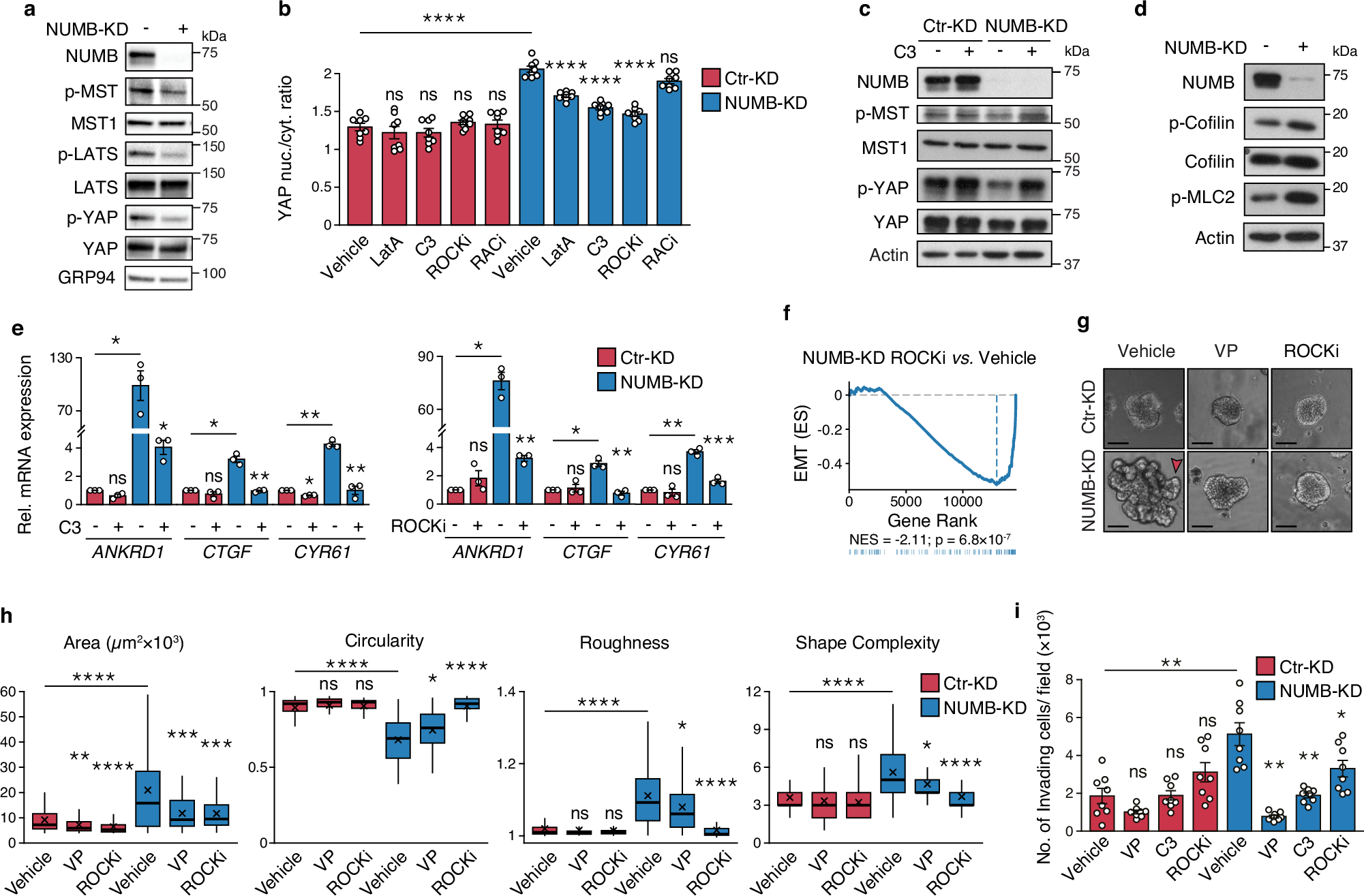 Fig. 8: Loss of NUMB triggers RHOA/ROCK-dependent YAP hyperactivation in human RT4 BCa cells.