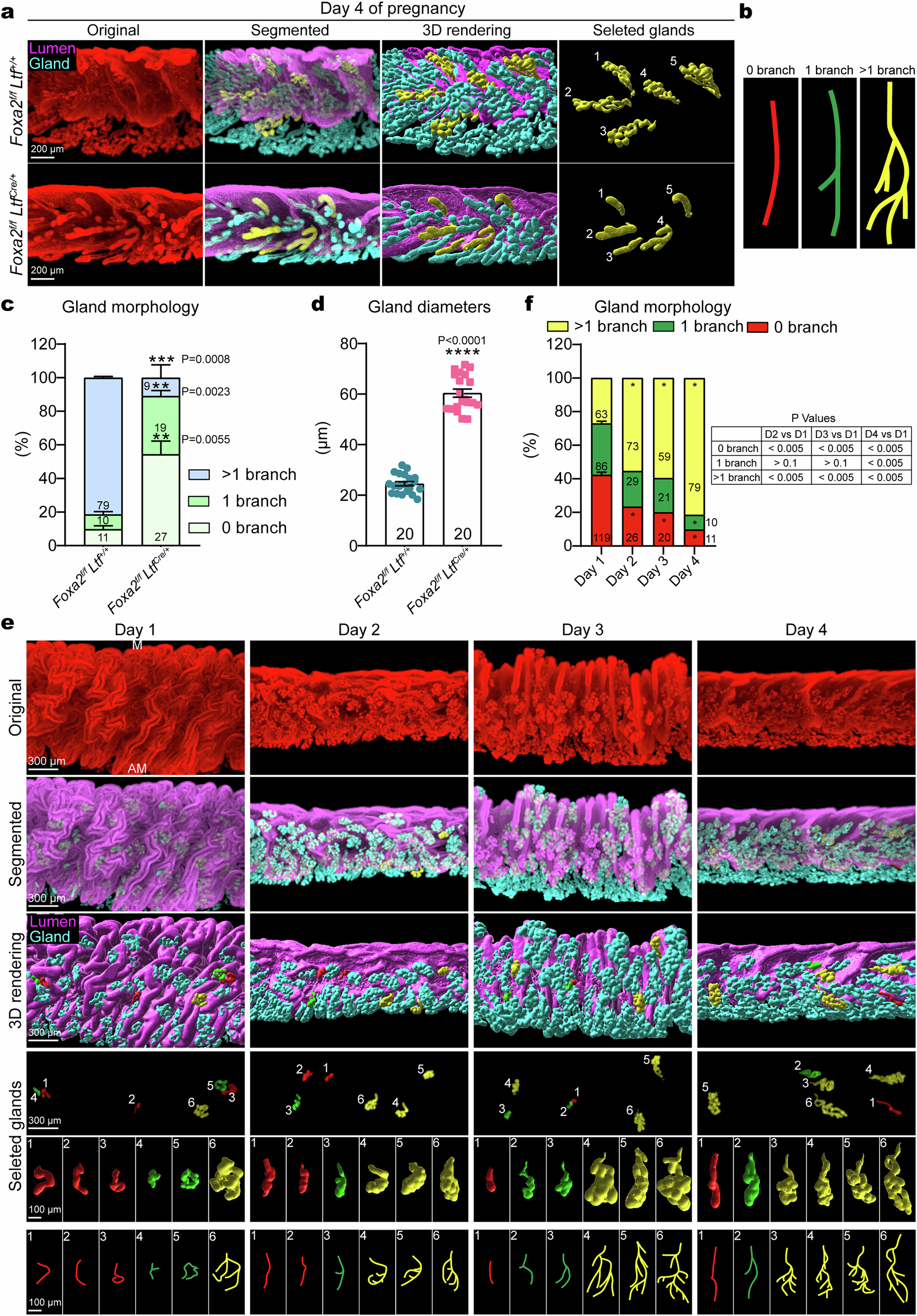 Fig. 1: Uterine epithelial deficiency of Foxa2 disrupts normal glandular morphological development before implantation.