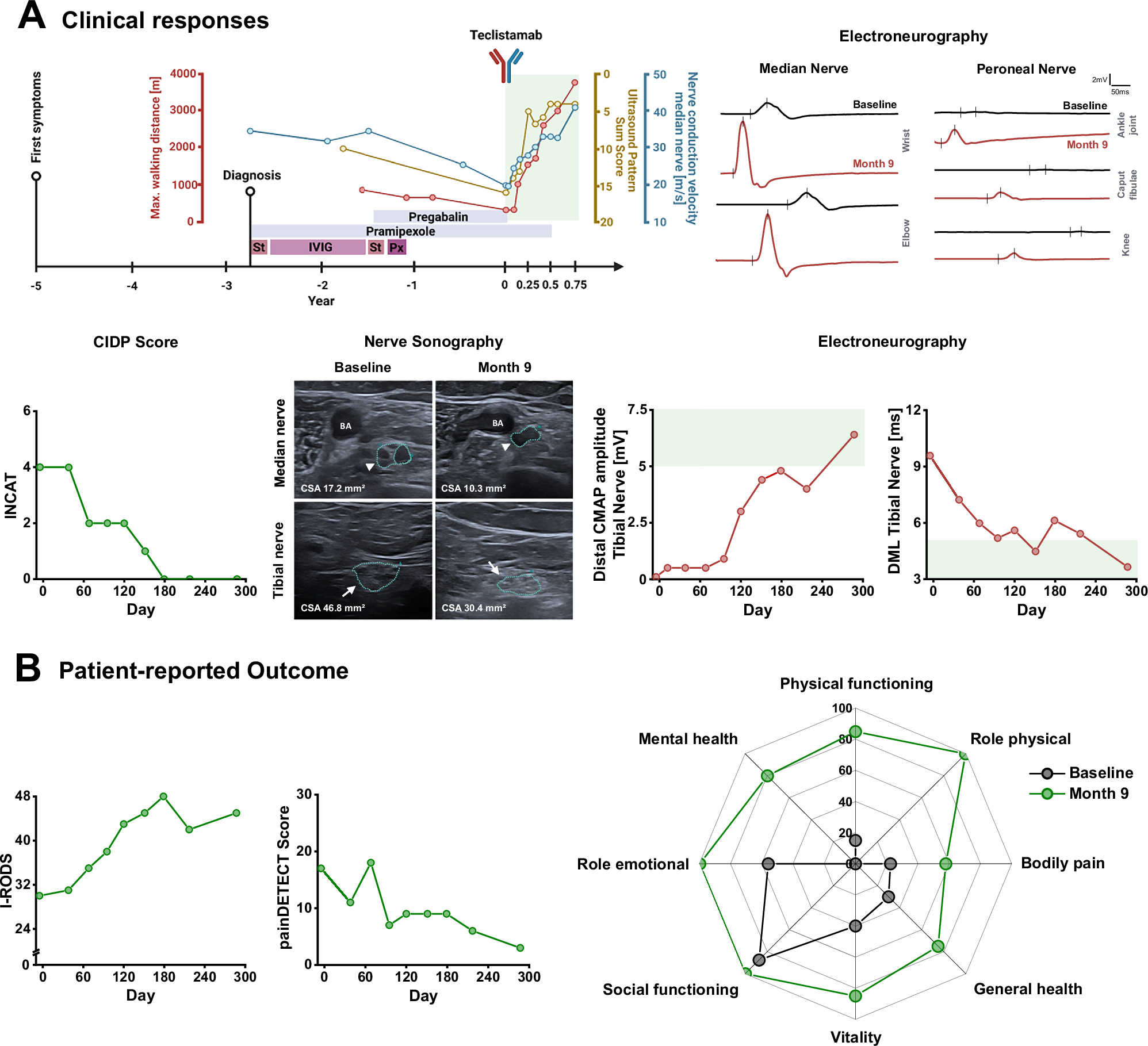 Fig. 1: Patient 1: Clinical responses and patient-reported outcome in refractory IgM-paraproteinemic autoimmune neuropathy treated with teclistamab.