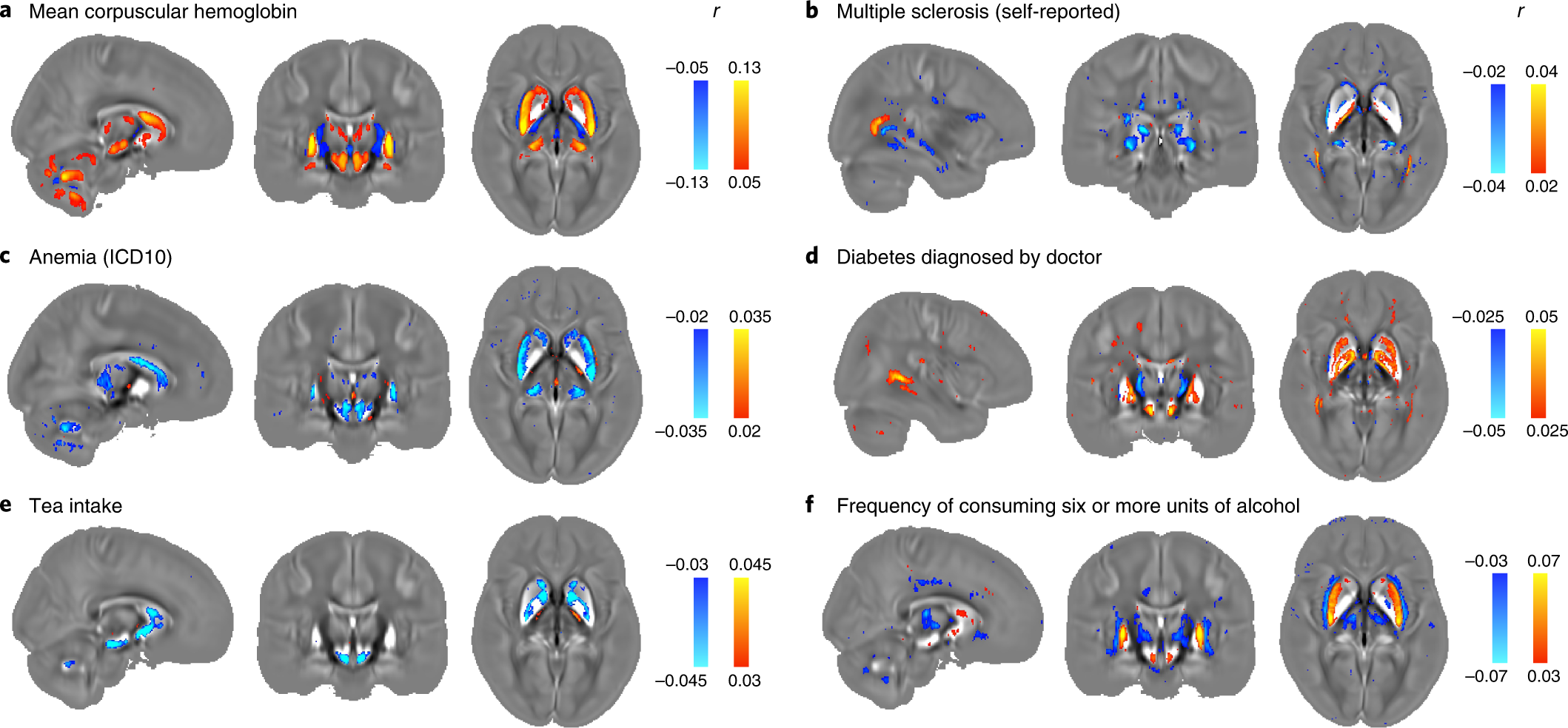 Fig. 4: Voxel-wise association maps of six example phenotypes with χ maps (aligned in MNI space) from 35,273 participants.