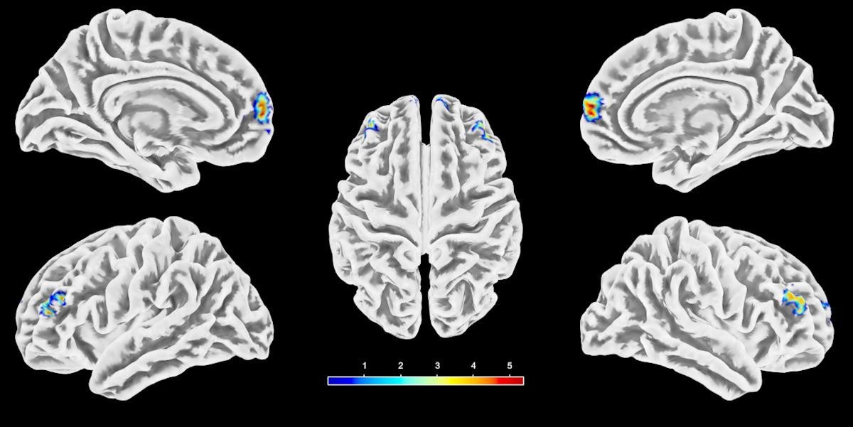 Fig. 2