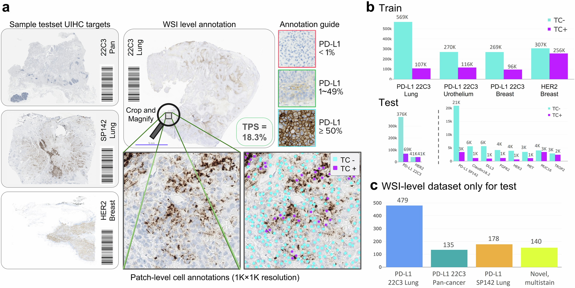 Fig. 8: Data pipeline for Universal Immunohistochemistry (UIHC) artificial intelligence (AI) model.