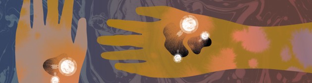 Cancer immunotherapy  