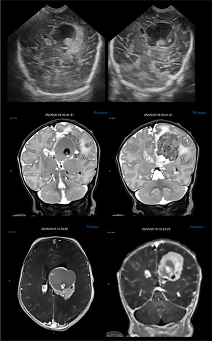 Fig. 5