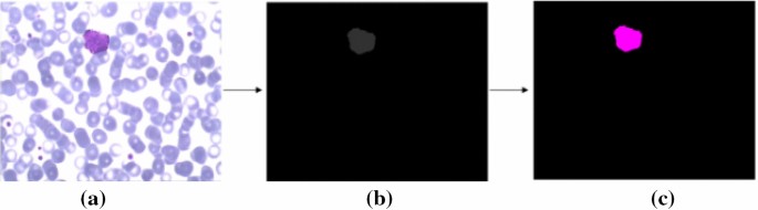 Fig. 12