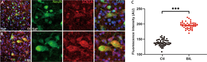 Fig. 3: BIL elevated the expression level of SCN1A in MVN neurons.