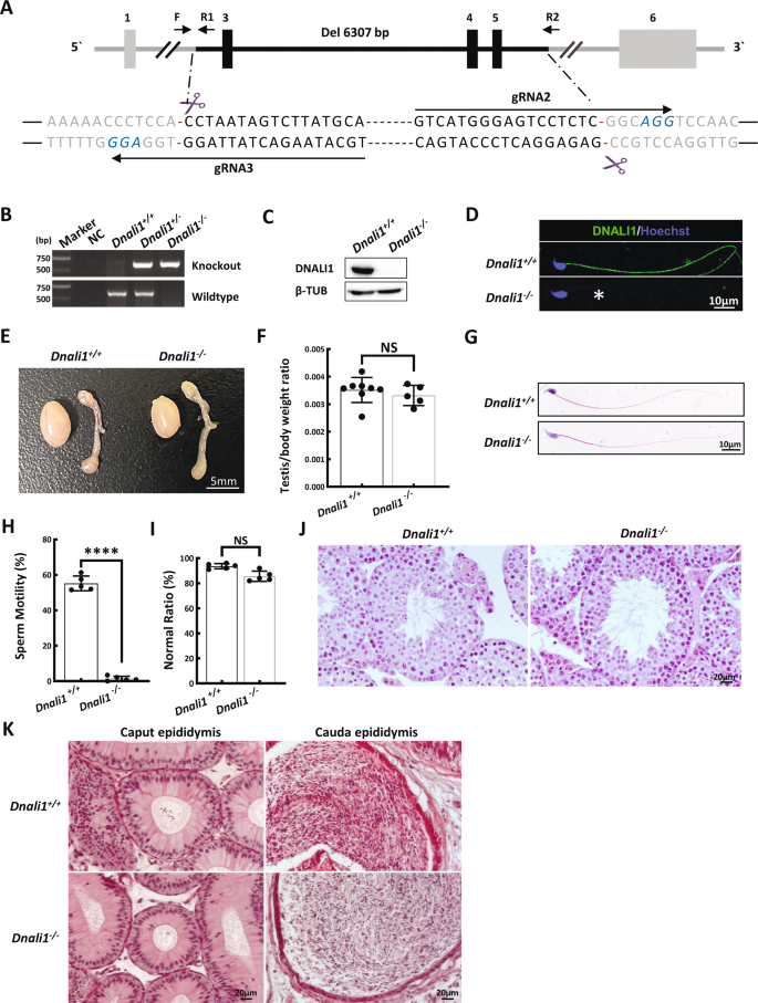 Fig. 3: Dnali1−/− males display asthenozoospermia (ASZ).