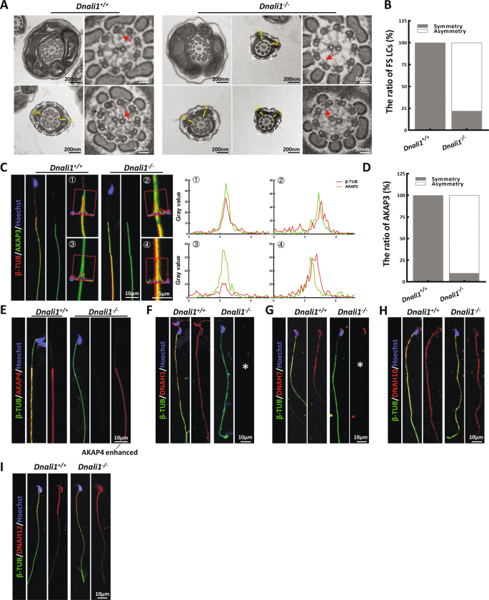 Fig. 4: The LCs position of the Dnali1−/− spermatozoa is asymmetrical and the IDA components are incomplete.