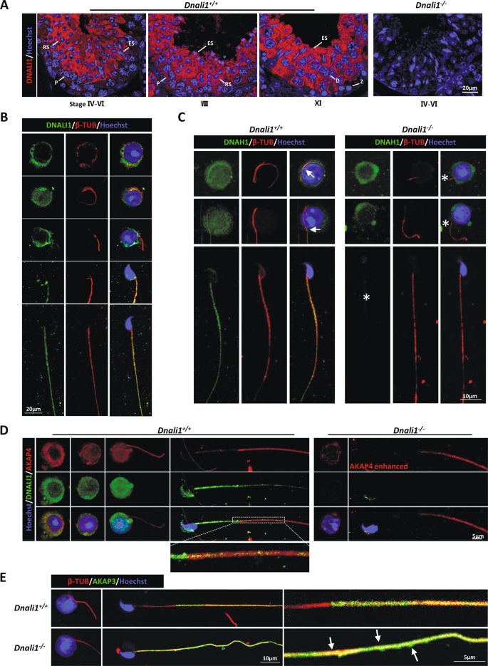 Fig. 5: DNALI1 localizes in the cytoplasm of spermatids and regulates the assembly of structural proteins in the flagellum.