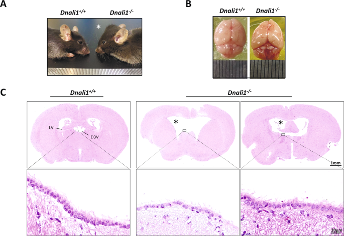 Fig. 7: Dnali1−/− mice have distinct hydrocephalus.