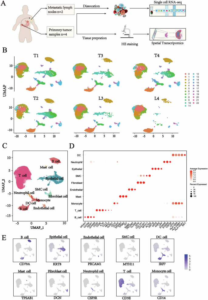 Fig. 1: Single-cell transcriptomic analysis of the cellular composition in matched primary gastric tumors and metastatic lymph nodes.