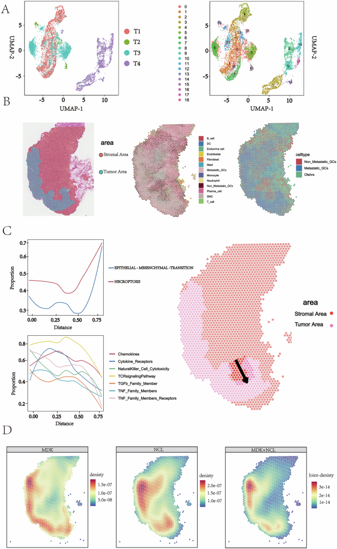 Fig. 7: Spatial and molecular dynamics of gastric cancer metastasis revealed by integrated ST.