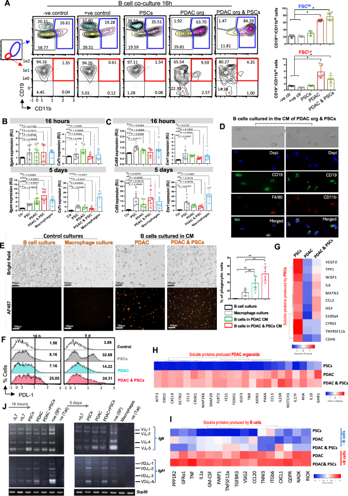 Fig. 2: B lymphocytes acquire a myeloid phenotype in PDAC TME.