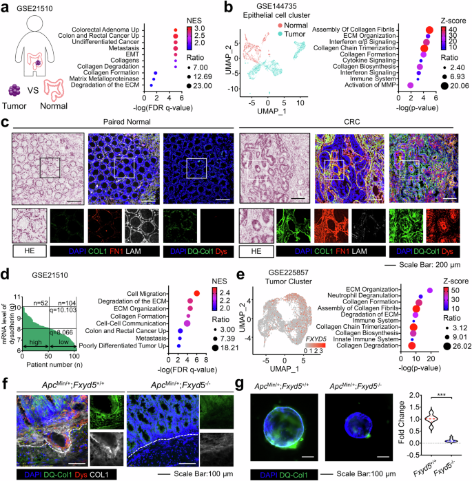 Fig. 1: Dysadherin expression is associated with ECM remodeling in CRC.