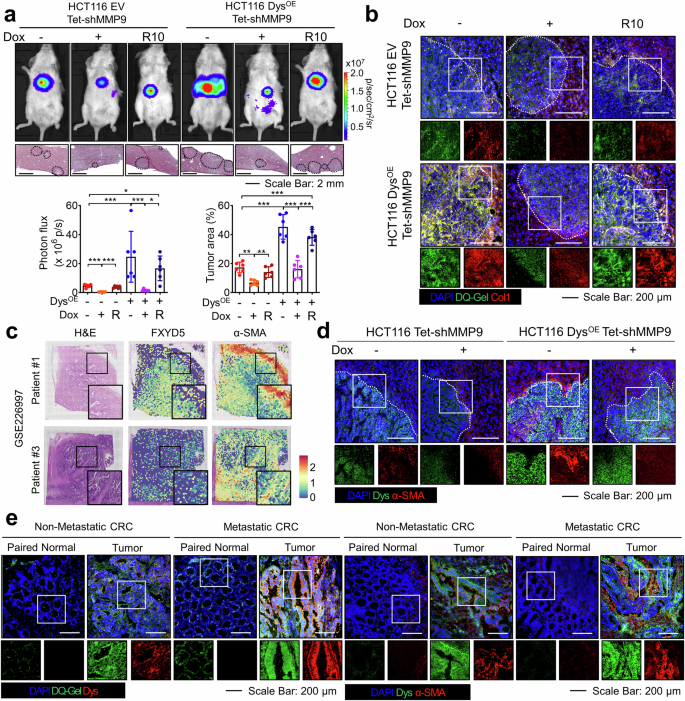 Fig. 3: The dysadherin/MMP9 axis enhances the metastatic potential via CAF activation.