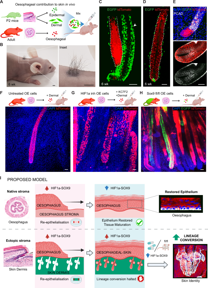 Fig. 7: HIF1a-SOX9 axis regulate oesophageal-to-skin lineage conversion in vivo.