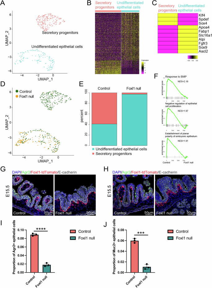 Fig. 6: Foxl1-dependent telocyte signals impact epithelial gene expression in the fetal gut.