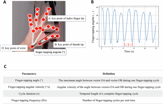 Fig. 5: Identification of finger key points, finger-tapping cycles, and calculation of kinematic parameters.