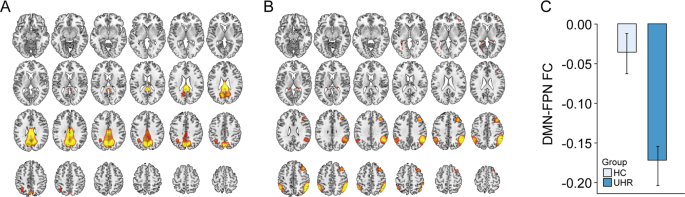 Fig. 2: The DMN-FPN network FC differences between HC and UHR.