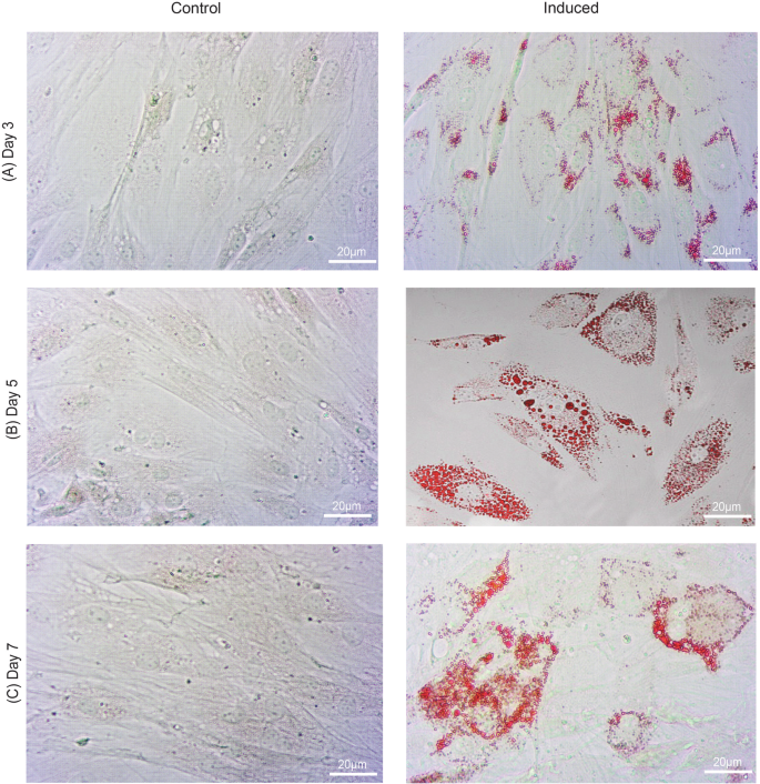 Fig. 2: Bovine preadipocytes induced and stained using Oil Red O.